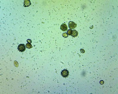 clusters of microscopic spikey and ovular shapes in blue/green soil solution, surrounded by small dots of bacteria and microorganisms