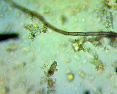  horizontal light brown hyphal strand with segments, crosses greeny / blue/ gold background containing microscopic soil aggregates and organic matter 