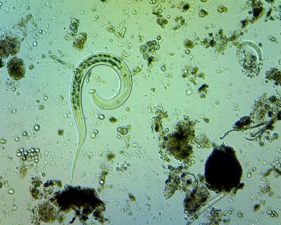 a microscopic nematode worm moving through greeny/blue soil solution